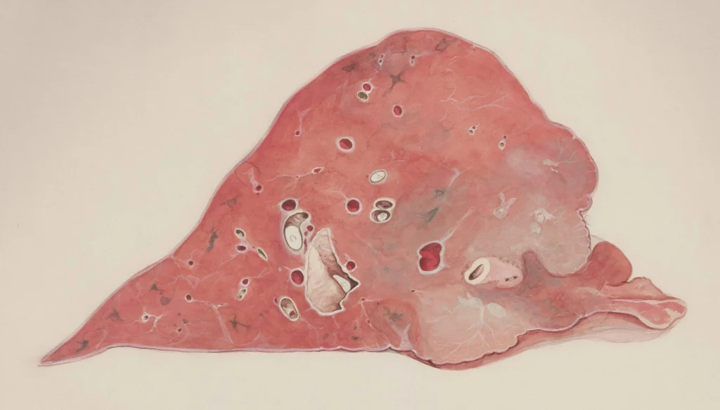 foods that support your liver naturally and daily habits